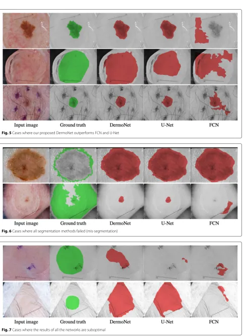 Fig. 5 Cases where our proposed DermoNet outperforms FCN and U-Net