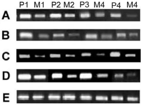 Figure 1Semi-quantitative RT-PCR analysis of selected genesSemi-quantitative RT-PCR analysis of selected genes