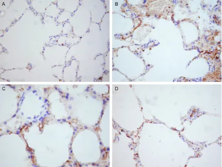 Figure 6. Ultrastructure change of lung tissue. A. Sham group demonstrating normal pathological and the alveolar epithelial walls were well maintained