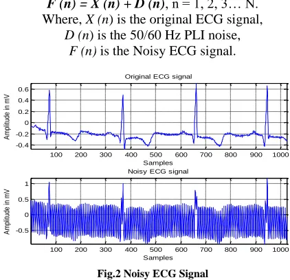 Fig.2 Noisy ECG Signal 