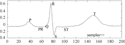Figure 1. ECG waveform. 
