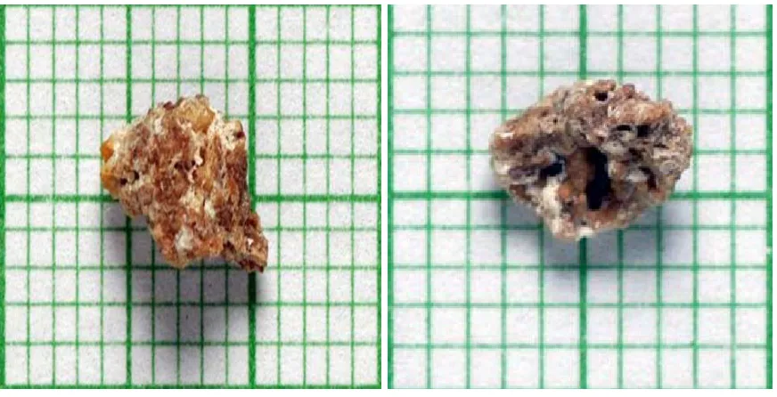 Figure 2. Stone-2. 