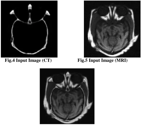 Fig.4 Input Image (CT)                      Fig.5 Input Image (MRI)  