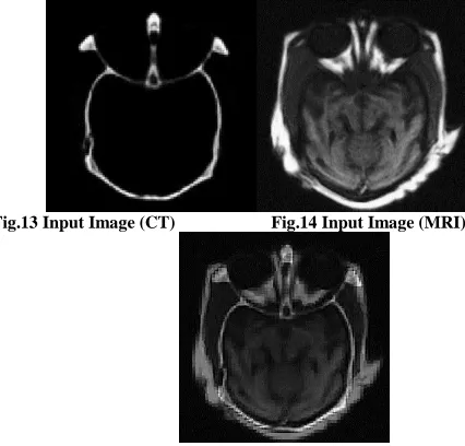 Fig.15 Output Image of (M-5) 