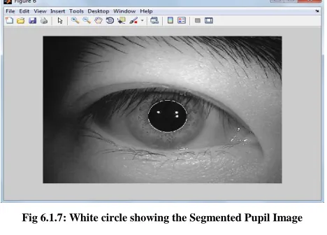 Fig 6.1.6: The specular reflections are removed using morphological operator 