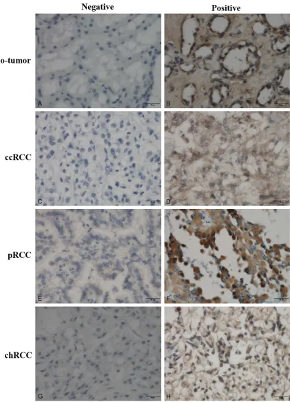 Figure 3. Representative immunohistochemical staining of DNMT3B protein in tissue samples (original magnifica-tion, ×400 in A-H).