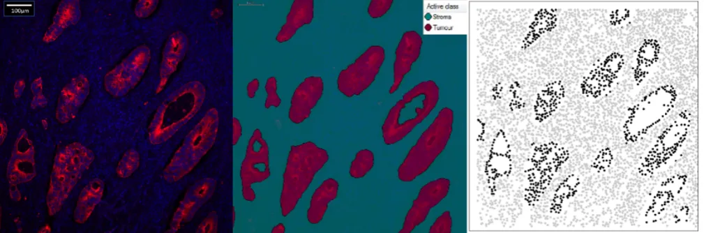 FIGURE 3 Illustration of one image of a patient’s slide which enables the pinpointing of nuclei