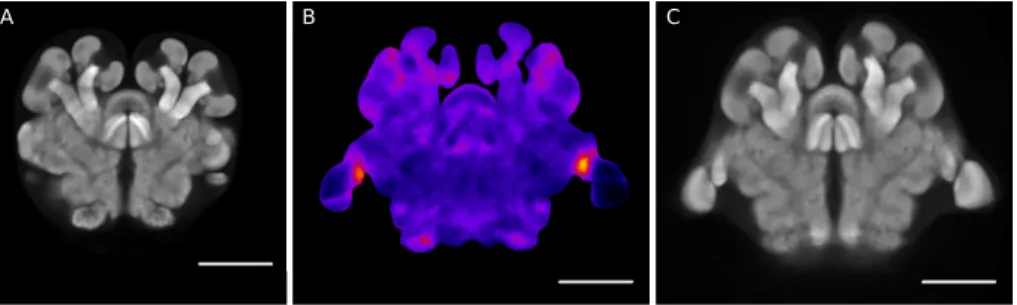 Figure 5: Inter-type deformation-based morphometry. From left to right: cen- cen-tral view of P
