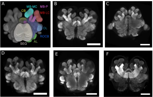Figure 1: Examples of brain samples and labeled regions. From left to right and from top to bottom: 3D view of anatomical regions (A) and central sections of P.