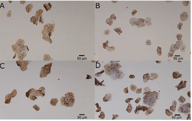 Figure 3. Lectin stain. (A): DM RCA120, (B): control RCA120, (C): DM PNA, (D): control PNA