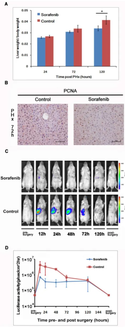 Fig 6.Sorafenib suppressed partial hepatectomy-induced liver regeneration via down-regulating NF-κB activation
