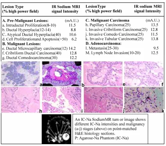 Figure 4. A Comparison between normal and malignant hu-man breast epithelial cells (grown in a 2D monolayer and 3D culture matrix) shows a role of EGF in luminal structure for-mation