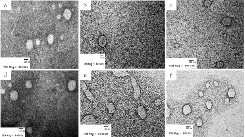 Figure 2. The Effect of incorporation of dug on the particle size of SLNs and NLCs 