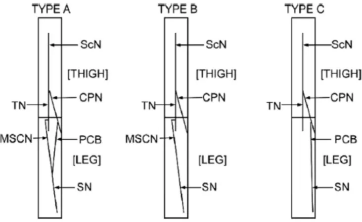 Figure 3.Schematic diagram showing the different types of formation of the sural nerve as described by Huelke (1957)