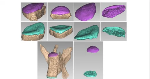 Fig. 12 The segmentation results in terms of 2D slices. The proposed method is employed to a randomly selected vertebra, the color regions of the12 slices in the first, and second two rows are two endplates of the vertebra respectively