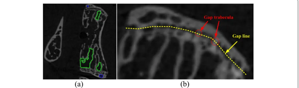 Fig. 1 Demonstration of endplate segmentation difficulties. a A sagittal view of the micro-CT data, where the blue and green marked the spongystructure caused by the cancellous bone
