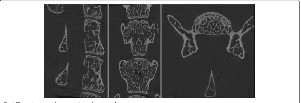 Fig. 2 The sagittal, coronal, and axial views of the input data