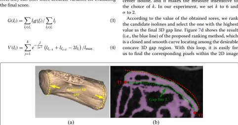 Fig. 5 Endplate region extraction.slices. The horizontal axis is the slice index, the vertical axis is the bone density value accordingly, a Axial views (right) of four typical slices of index a, b, c, and d (left)