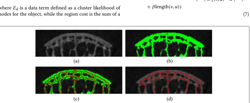 Fig. 9 The skeletonisation process.Skeletonisation result from a The input image. b The mask image resulting from a, where the foreground bone tissues are in green