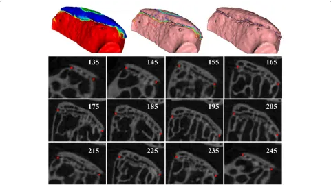 Fig. 11 Experimental results of shape priori extraction. The generated harmonic field, isoline candidates and the resulting 3D gap line of a randomlyselected vertebra are shown in the first row from left to right respectively