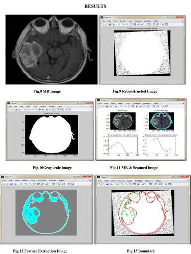Fig.8 MR Image                                                      Fig.9 Reconstructed Image   