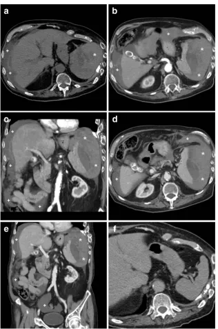 Fig. 2 An elderly 89-year-old male with chronic heart failure, previousvenous-phase (hypotension