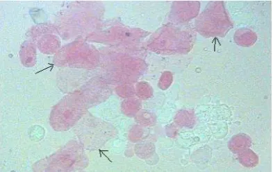 Table 1:  Effect of alcoholic extract of Solanum xanthocarpum on vaginal cornification in bilaterally ovariectomized albino rats