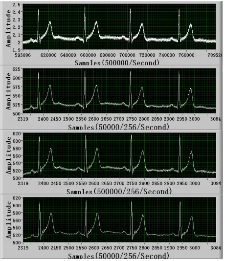 Figure 7. Sampling results without driven-right-leg circuit. 