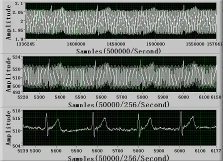 Figure 8. Sampling results from one arm (direct sample re- sult (upside), Oversampling result (middle), result after over-sampling and low-pass filter and notch filter (downside))