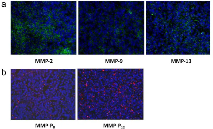 Figure 6. (a) Immunohistochemistry of MMP expression in a SCC7 tumor section counterstained with primary antibodies for MMP-2, 9, and 13, respectively