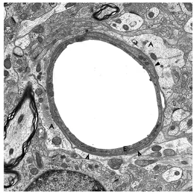 Fig. 7.Brain capillary. A:astrocytic processes; E:endothelium; Arrow heads: vasular basement membrane   