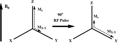 Figure 1. Schematic illustration of the change of net magnetization vector immediately after a radio-frequency pulse