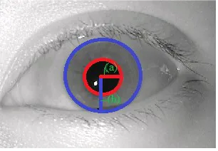 FIG  III: (A)PUPIL RADIUS (B)IRIS RADIUS 