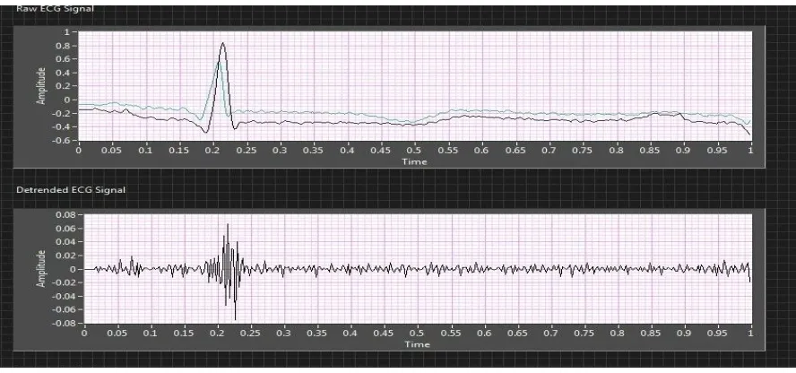 Figure 4: Using the WA Detrend VI to remove baseline wandering 