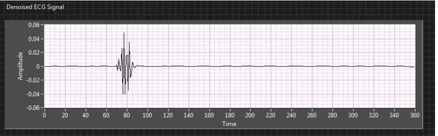 Figure 6. Removing wideband noise by applying UWT 
