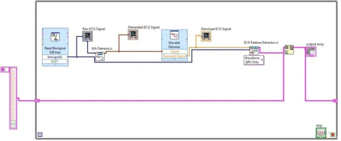 Figure 8. Implementation of QRS Detection 