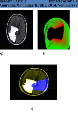 Figure (2) -Segmentation using proposed hybrid model. 