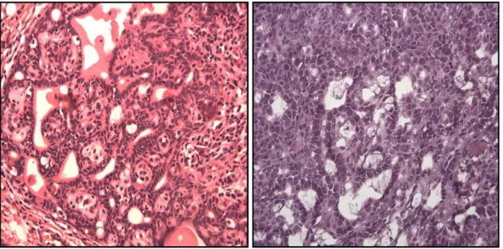 Figure 1 comparison between the level of corticosterone in the group with cic and ciic.Abbreviations: cic, cancer induction condition; ciic, cancer induction and isolation condition; se, standard error; vs, versus.