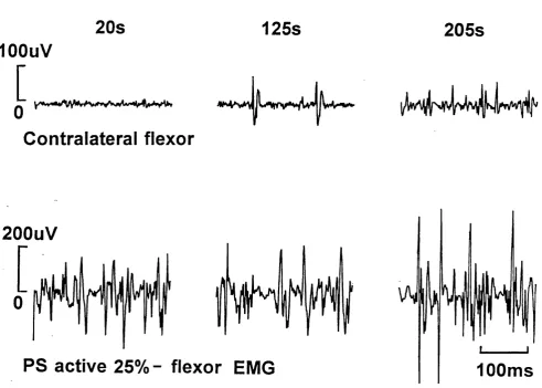 Figure 3: Subjects were instructed to grip the dynamometer in the preferred hand at 25% hand