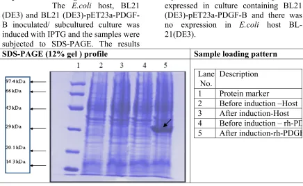 Figure 3: Analysis of Plasmid DNA Digestion samples by Agarose Gel Electrophoresis 
