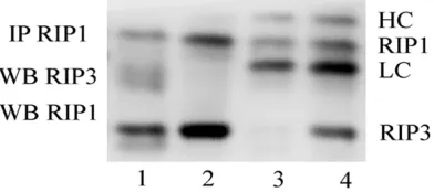 Figure 5. A: Western blot analysis of expression of RIP1, RIP3 proteins in bone marrow of mice with AA