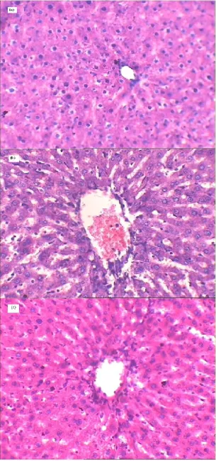 Figure 1. Histopathology of (a) normal rat liver (b) CCl4-intoxicated rat liver (c) ethanolic extract of E