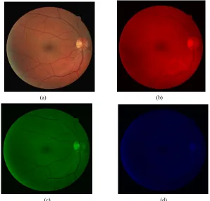 Figure 1. (a) Colour retinal image; (b-d) Red, Green and Blue component images. 
