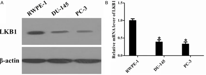 Figure 2. LKB1 mRNA and protein levels in prostate cancer cell lines. A. The protein expression profiles of the LKB1 in normal control cell lines (RWPE-1) and prostate cancer cell lines (DU-145 and PC-3) were determined by Western blot analysis