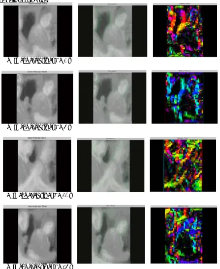 Figure 4. Result of (left) grayscale image, (middle) flow vector on image, and (right) segmented colour image