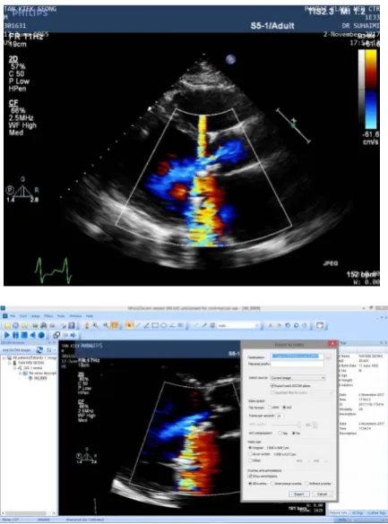Fig. 4.  Dicom interface for reading the ultrasound image and video conversion format