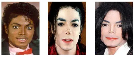 Fig. 1 The effect of plastic surgery on facial appearances. 
