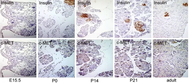 Figure 3. Immunohistochemical analysis of insulin and c-MET expression in the developing pancreas of E15.5, P0, P14, P21 and adult rats