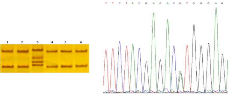Figure 1. SCN4A gene. Line 1 shows different pattern banding regard to lines 2, 3, 4, 5, 6, and 7
