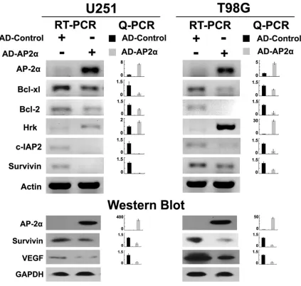 Figure 3. Overexpression of AP-2α was confirmed by PCR and WB. In glioma cells, ectopic expression of AD-AP2α resulted in significant downregulations of Bcl-2, Bcl-xl, c-IAP2 and Survivin mRNA levels, together with upregulation of Hrk mRNA level (upper) (r